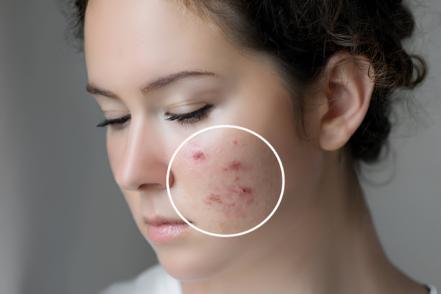 Symptoms of Elevated Prolactin Levels